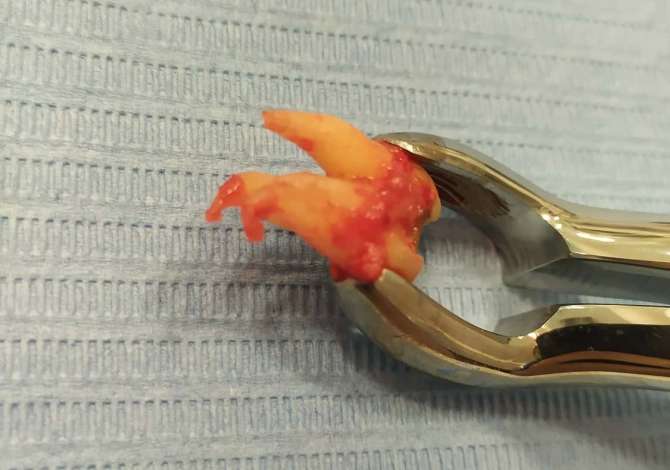 Klinika dentare ofron sherbime dentare Ortopedike , Kirurgjikale, Implante,dhe Terapi, 