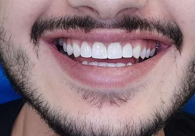 Sherbime Shendetesore dhe Estetike ne Tirane - 1,000 Leke