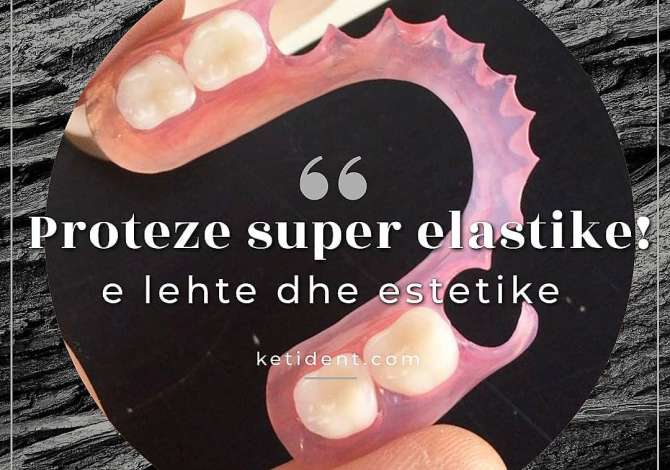 Klinika Dentare KetiDent ofron Mbushje estetike, Faseta dhe Buze, Zbardhim, Piercing, Fluorizim, Ura Porcelan dhe Zirkon etj.