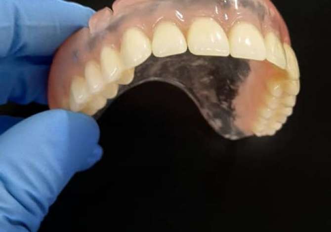 Klinika Dentare KetiDent ofron Mbushje estetike, Faseta dhe Buze, Zbardhim, Piercing, Fluorizim, Ura Porcelan dhe Zirkon etj.