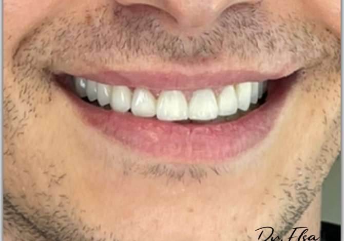 Klinike Dentare Integra ofron sherbime per Ortopedi Funksionale, Trajtime Ortodonik, Endodontik, Protetik, Kirurgji Orale, Implantim etj.