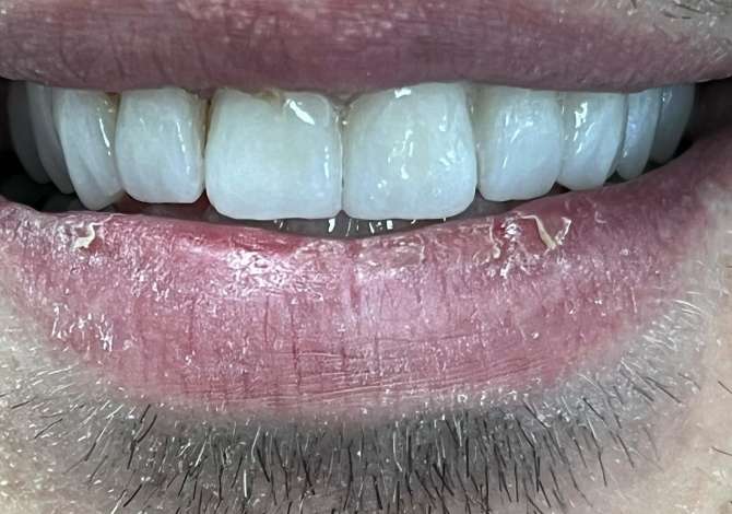 Klinike Dentare ofrojme  Kirurgji Orale, Turizem dentar 🇮🇹 Grafi Dentare dhe Tac 3d. Konsulta pa Pagese