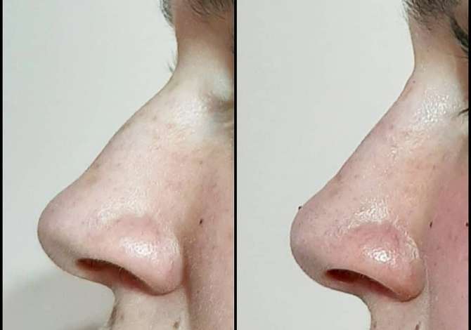 Sherbime Shendetesore dhe Estetike ne Tirane - 1,000 Leke