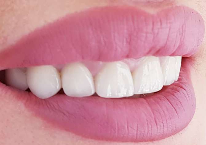 Klinika Dentare Universal me sherbime dentare terapeutike, kirurgjikale dhe estetike. Vizita GRATIS