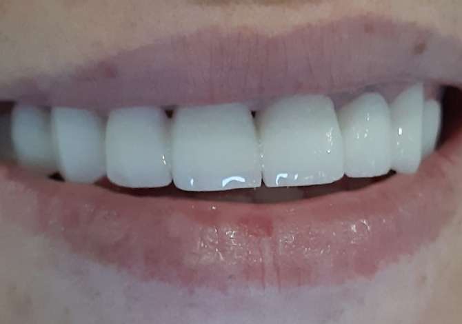 Health and Beauty Services in Tirana - 1,000 