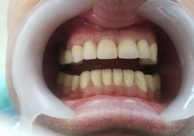 Health and Beauty Services in Tirana - 1,000 