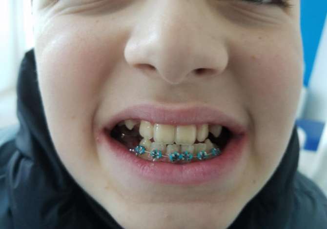 Health and Beauty Services in Tirana - 1,000 