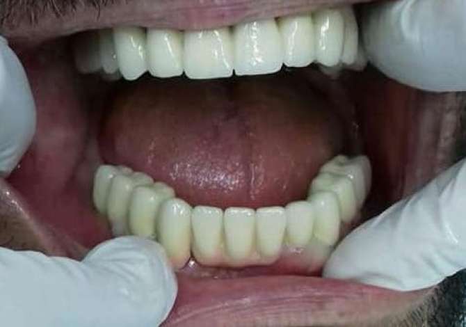 Sherbime Shendetesore dhe Estetike ne Tirane - 1,000 