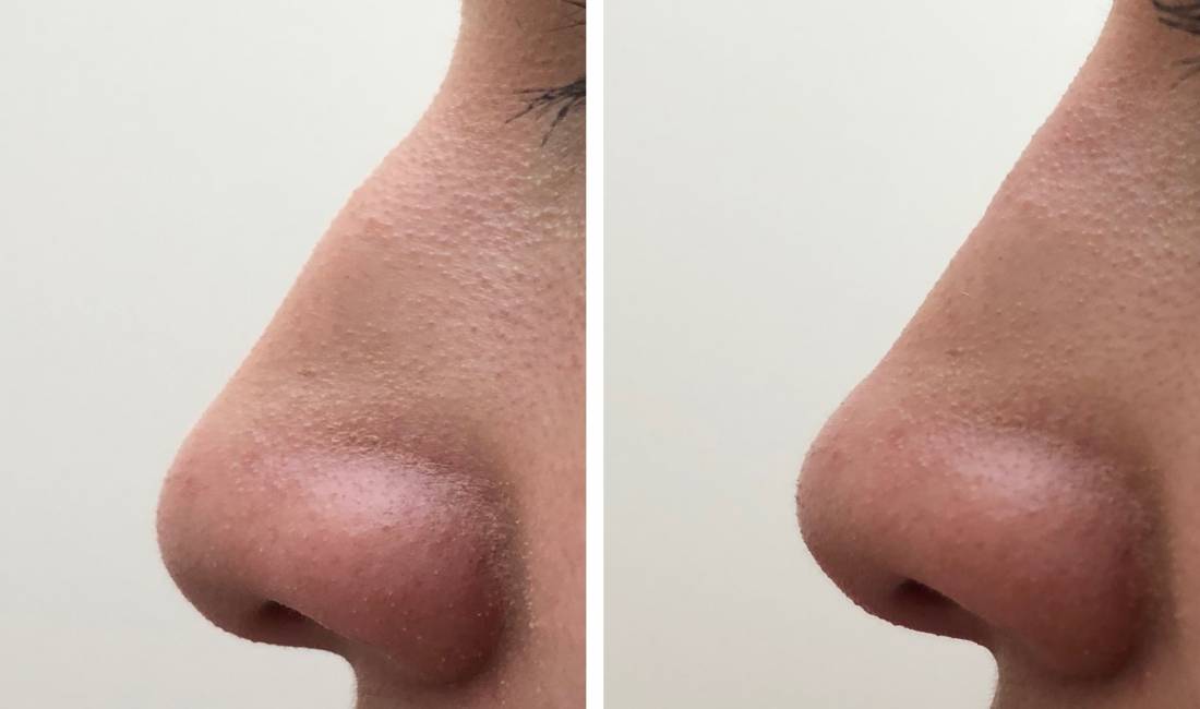 Klinika qe ofron sherbime te kirurgjise estetike, Oto-rino-laringologjise, Mbjellje e flokeve dhe trajtime estetik jo kirurgjikale 