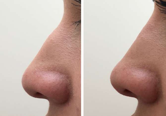 Sherbime Shendetesore dhe Estetike ne Tirane - 200 