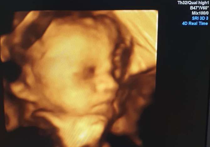 Klinike e specializuar per Obstetrike-Gjinekologji 