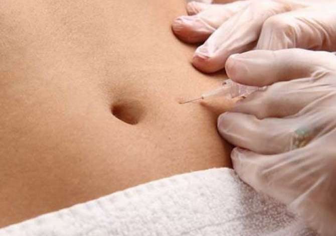 Klinika dermatologjike ofron trajtime  jo invazive, pa nevojen e nderhyrjeve kirurgjikale