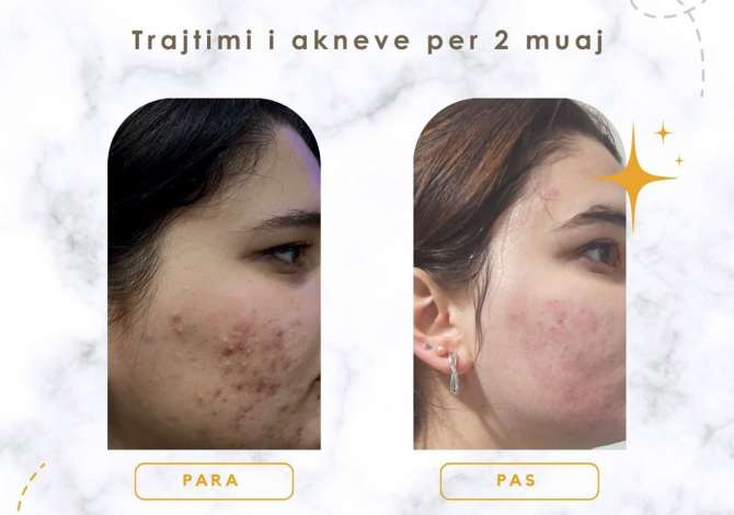 Klinike Dermatologjike per sherbime dhe trajtime cilesore. Kontroll i lekures dhe nishaneve, Blv Gjergj Fishta