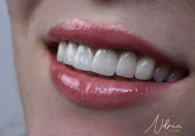 Klinik Dentare dhe Laborator Ndriodent ofron sherbim per Terapi, Endodonti, Kirurgji, Ortopedi, Implantologji dhe Ortodonci