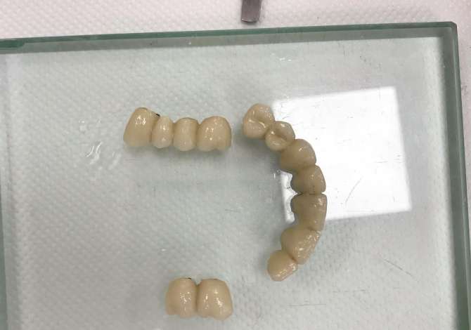 Sherbime Shendetesore dhe Estetike ne Tirane - 1,000 