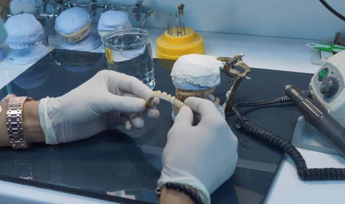 Poliklinika dentare ofron sherbime ne proteze,kirurgji ortodenci,terapi radiologji