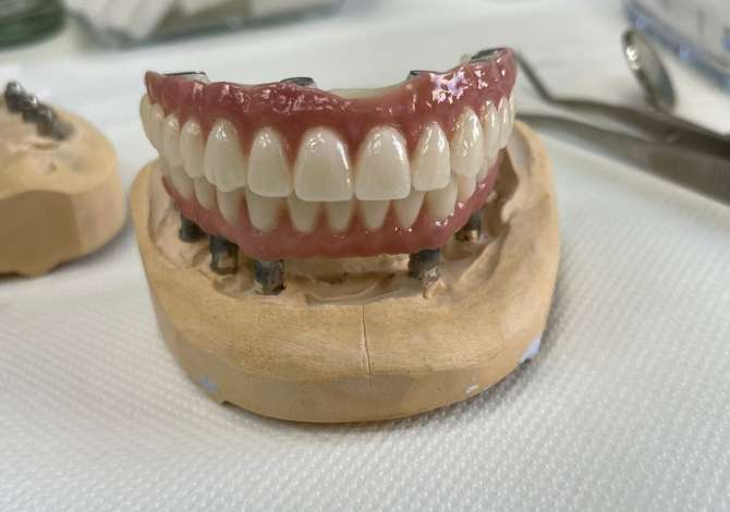 Poliklinika dentare ofron sherbime ne proteze,kirurgji ortodenci,terapi radiologji