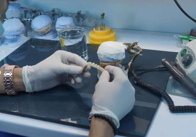 Sherbime Shendetesore dhe Estetike ne Tirane - 1,000 