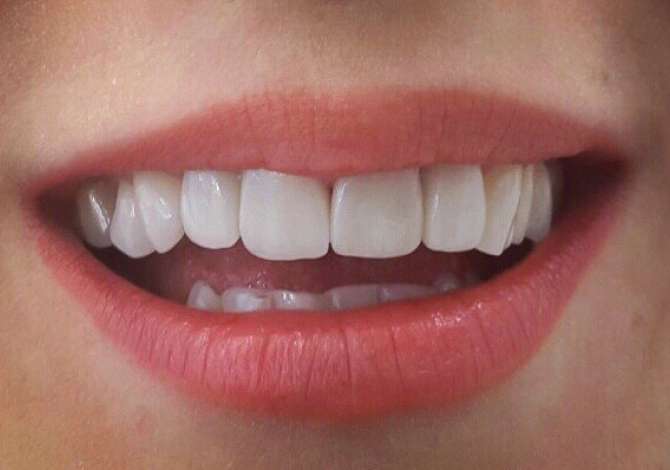 Sherbime Shendetesore dhe Estetike ne Tirane - 1,000 