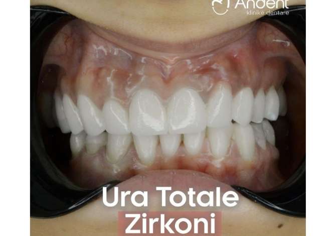 Klinika Dentare  kryen Pastrim, Zbardhim, Mbushje, Heqje, Implante, Ura fikse, Protza dhe Ortodontci