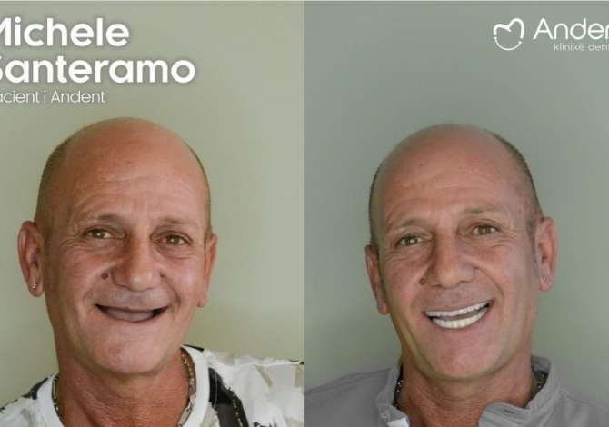 Klinika Dentare  kryen Pastrim, Zbardhim, Mbushje, Heqje, Implante, Ura fikse, Protza dhe Ortodontci