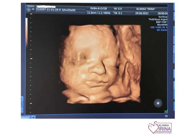 Sherbime Shendetesore dhe Estetike ne Elbasan - 0 