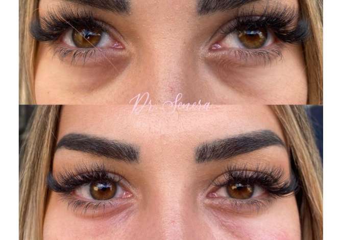 Kirurgji Plastike & Estetike kryesisht per fytyren