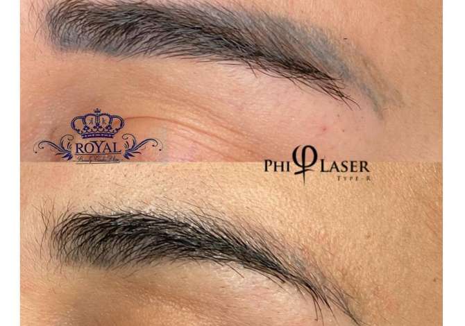 Klinike estetike e  specializuar per eleminim te rrudhave me aparaturen Fisiotron