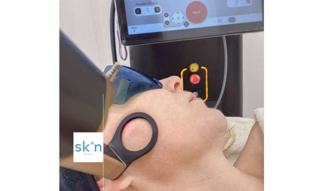 Klinike e specializuar ne trajtimin revolucionar te fytyres PA GJILPËRA