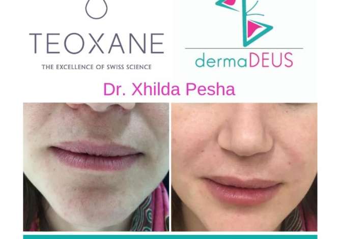 Sherbime Shendetesore dhe Estetike ne Fier - 0 