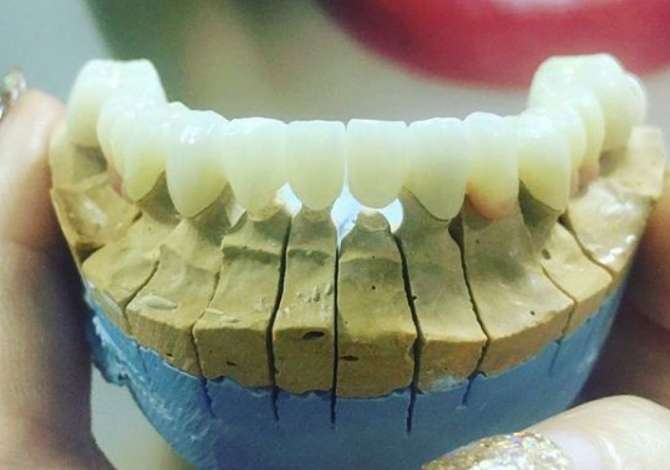 Klinike dentare e specializuar ne implantologji , porcela, zirkon, EMAX