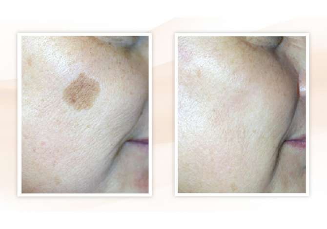 Klinika qe ofron sherbime te kirurgjise estetike, Oto-rino-laringologjise, Mbjellje e flokeve dhe trajtime estetik jo kirurgjikale 