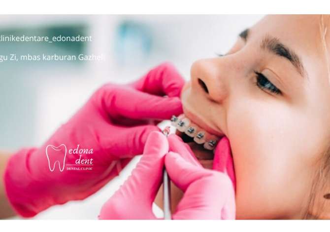 Sherbime Shendetesore dhe Estetike ne Tirane - 0 Euro