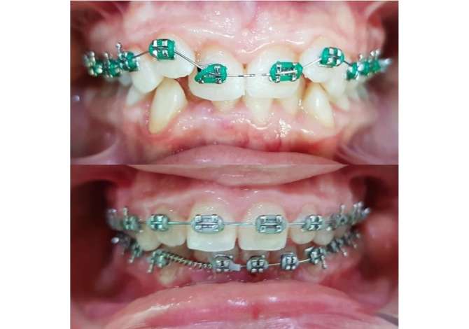 Sherbime Shendetesore dhe Estetike ne Berat - 0 