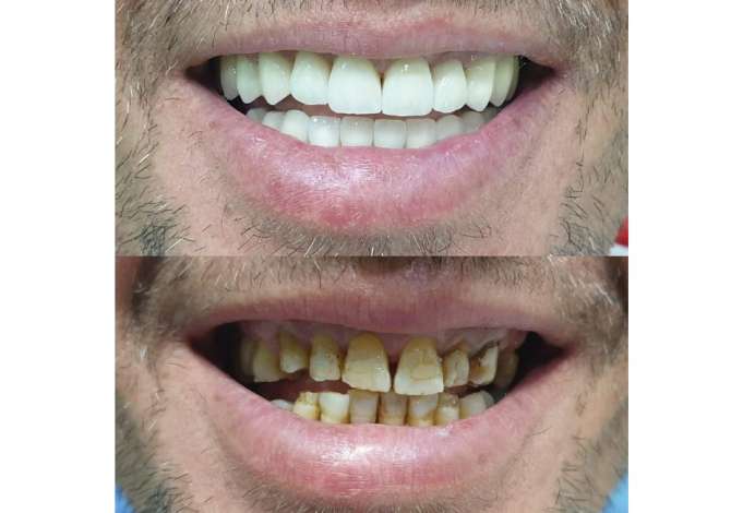 Klinike dentare ofron sherbime ne Implantologji, Ortodonci (aparate te levizshme, fikse, Maskerina transparente) etj.