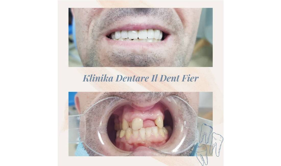 Klinika dentare ofron sherbim te specializuar ne kirurgji orale, ortodonci, endodonci, implantologji etj.