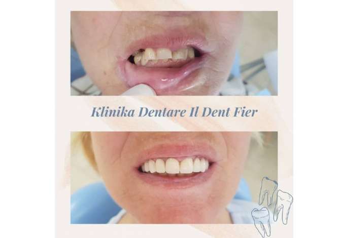 Klinika dentare ofron sherbim te specializuar ne kirurgji orale, ortodonci, endodonci, implantologji etj.