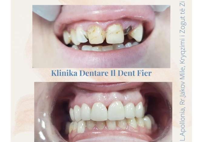 Klinika dentare ofron sherbim te specializuar ne kirurgji orale, ortodonci, endodonci, implantologji etj.
