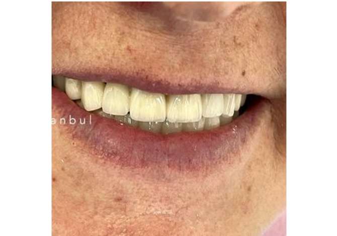 Sherbime Shendetesore dhe Estetike ne Elbasan - 0 