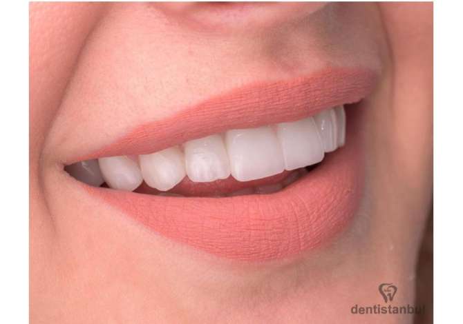 Sherbime Shendetesore dhe Estetike ne Elbasan - 0 