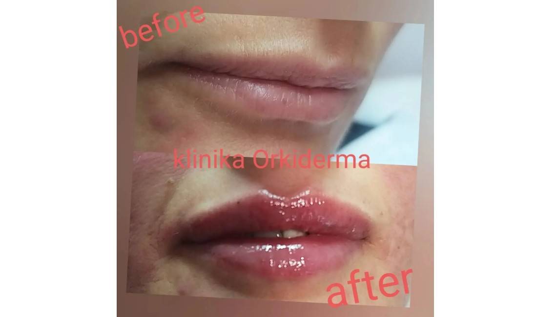 Klinik estetike ne Korce oforn sherbime per probleme patologjike te lekures, flokeve, thonjeve, sherbime rigjeneruese etj.