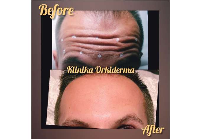 Sherbime Shendetesore dhe Estetike ne Korce - 0 