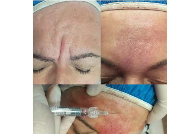 Sherbime Shendetesore dhe Estetike ne Korce - 0 