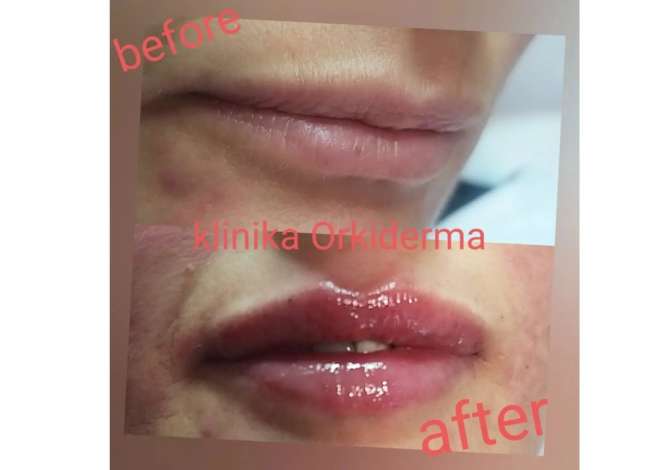 Sherbime Shendetesore dhe Estetike ne Korce - 0 