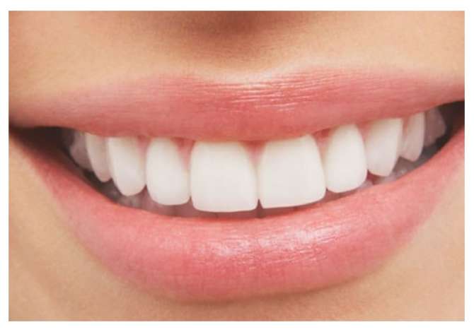 Klinika dentare ofron sherbim te specializuar ortodontik cilesor dhe garanton rezultatet e tij