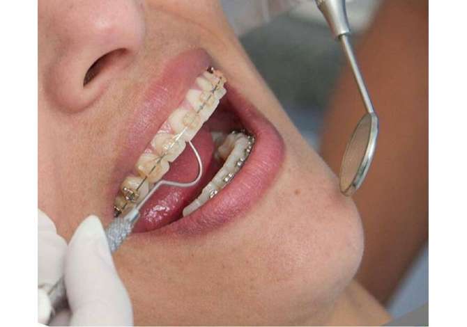 Sherbime Shendetesore dhe Estetike ne Fier - 0 