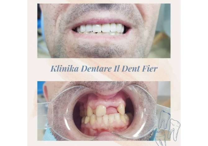 Klinika dentare ofron sherbim te specializuar ortodontik cilesor dhe garanton rezultatet e tij