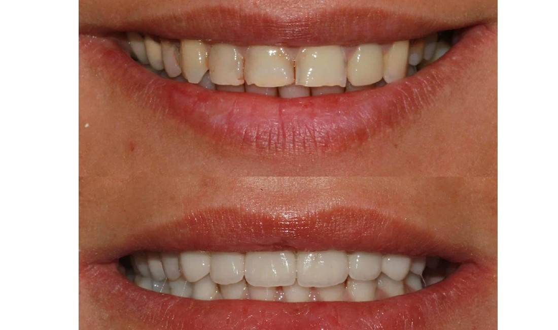 Klinike stomatologjike multidisiplinare ne Shqiperi qe ndjek CDA's