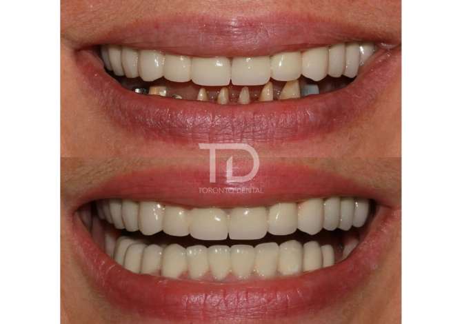 Klinike stomatologjike multidisiplinare ne Shqiperi qe ndjek CDA's