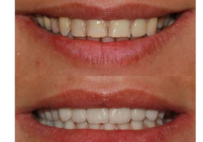 Sherbime Shendetesore dhe Estetike ne Tirane - 0 